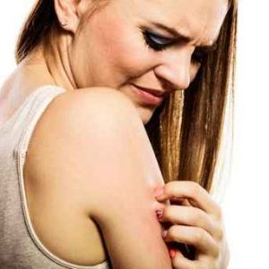 Itchy Skin from Eczema